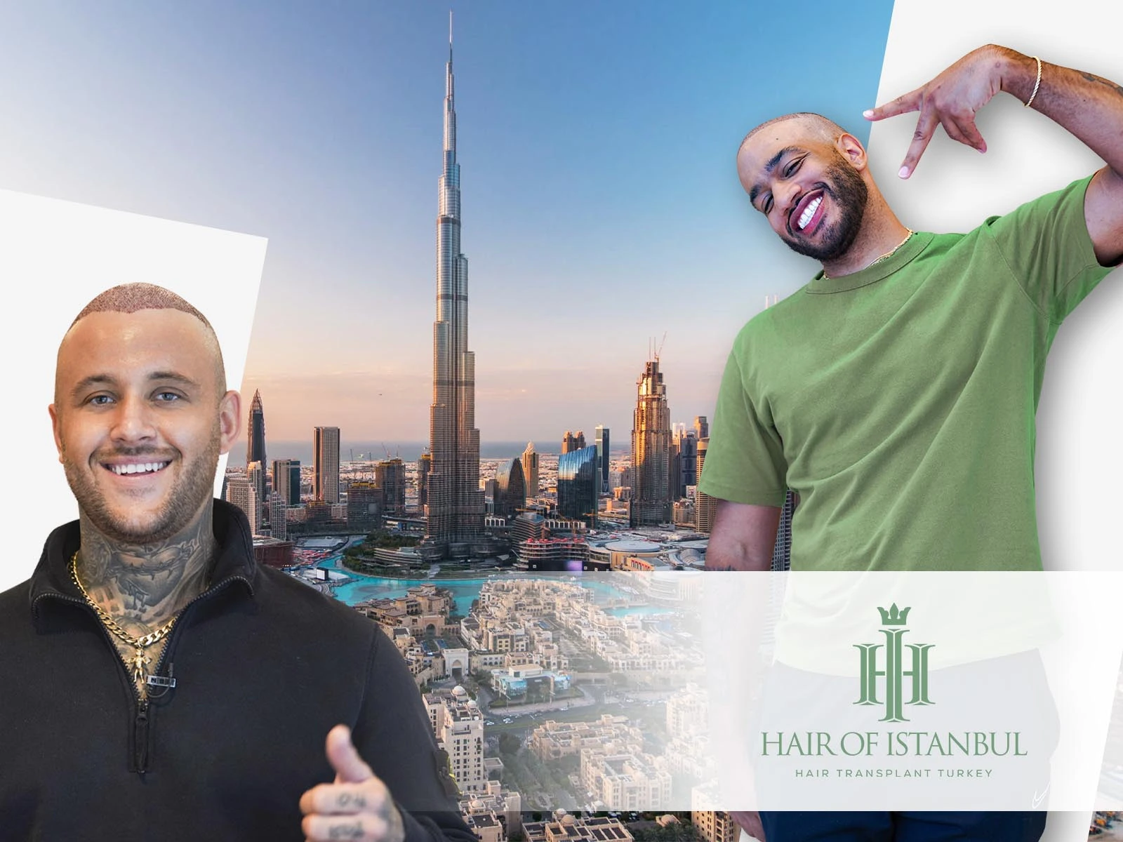 Dubai Hair Transplant: Modern Solutions with Natural Results