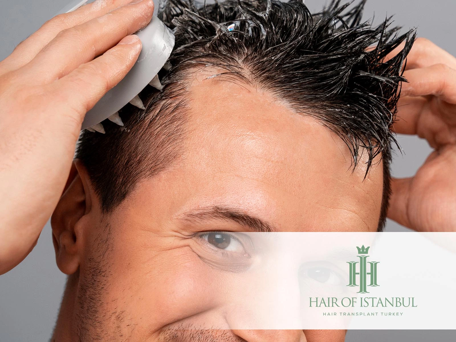 Hair Care After Hair Transplant: Expert Tips for Lasting Results