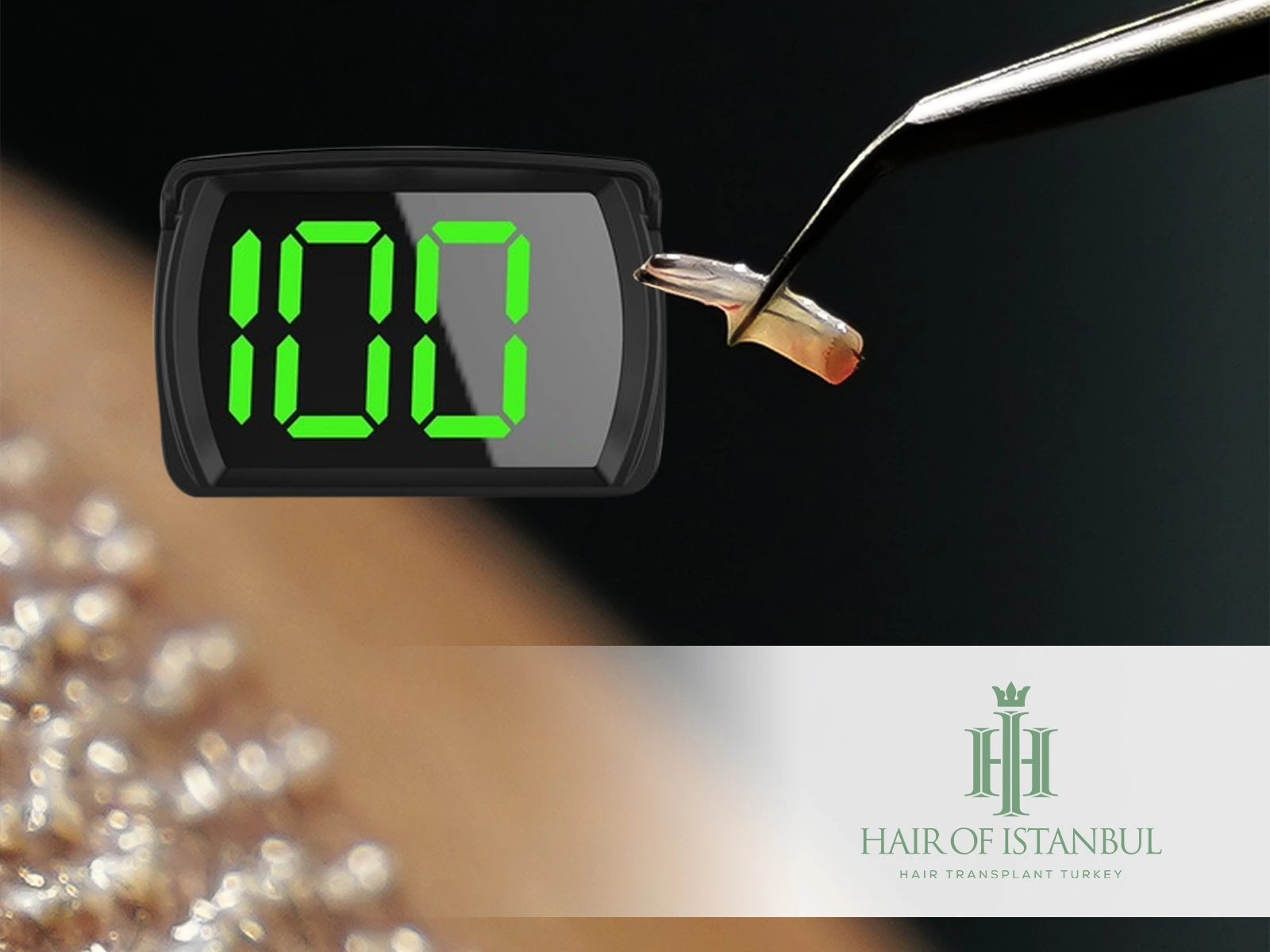 Hair Graft Calculator: Estimate Your Hair Transplant Needs with Confidence