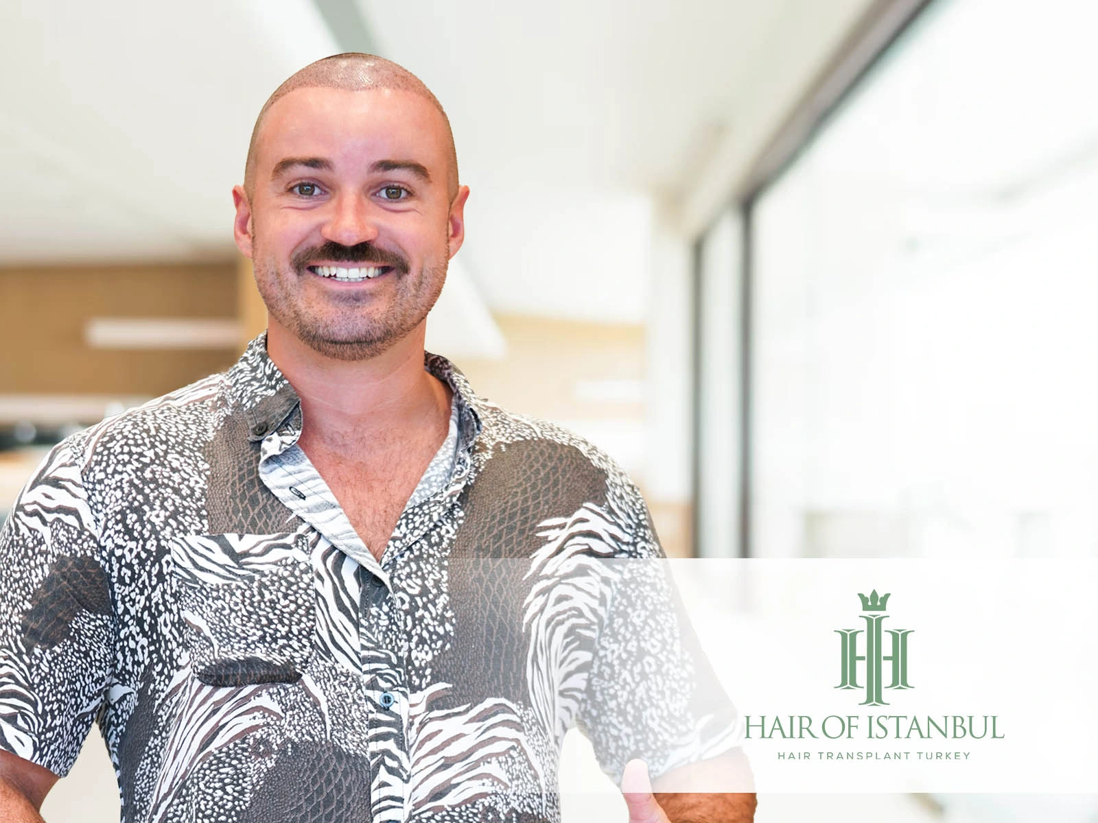 Hair Transplant Downtime: Can You Return to Work the Next Day?