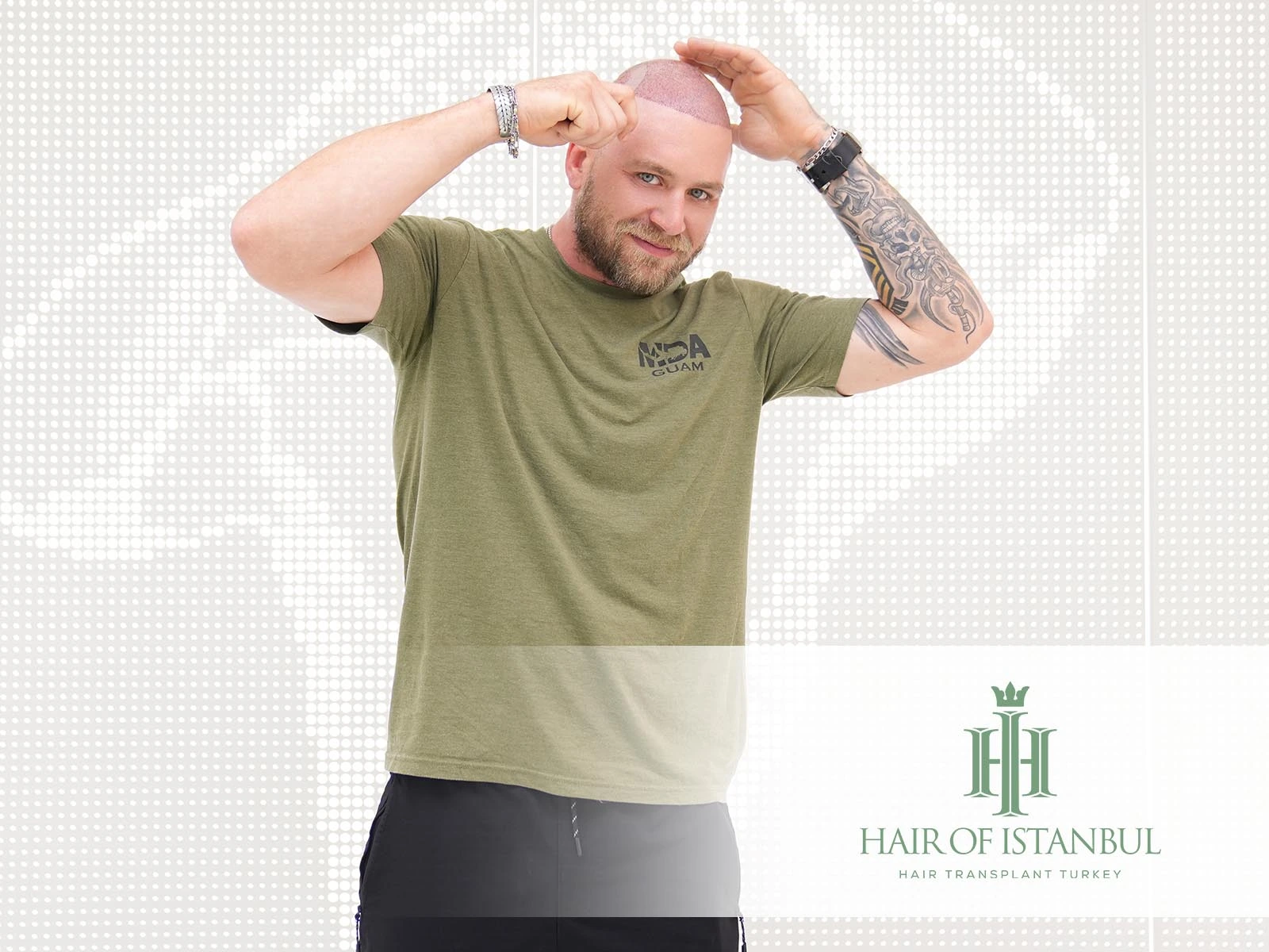 Hair Transplant Preparation: Essential Pre-Op Tips for Success