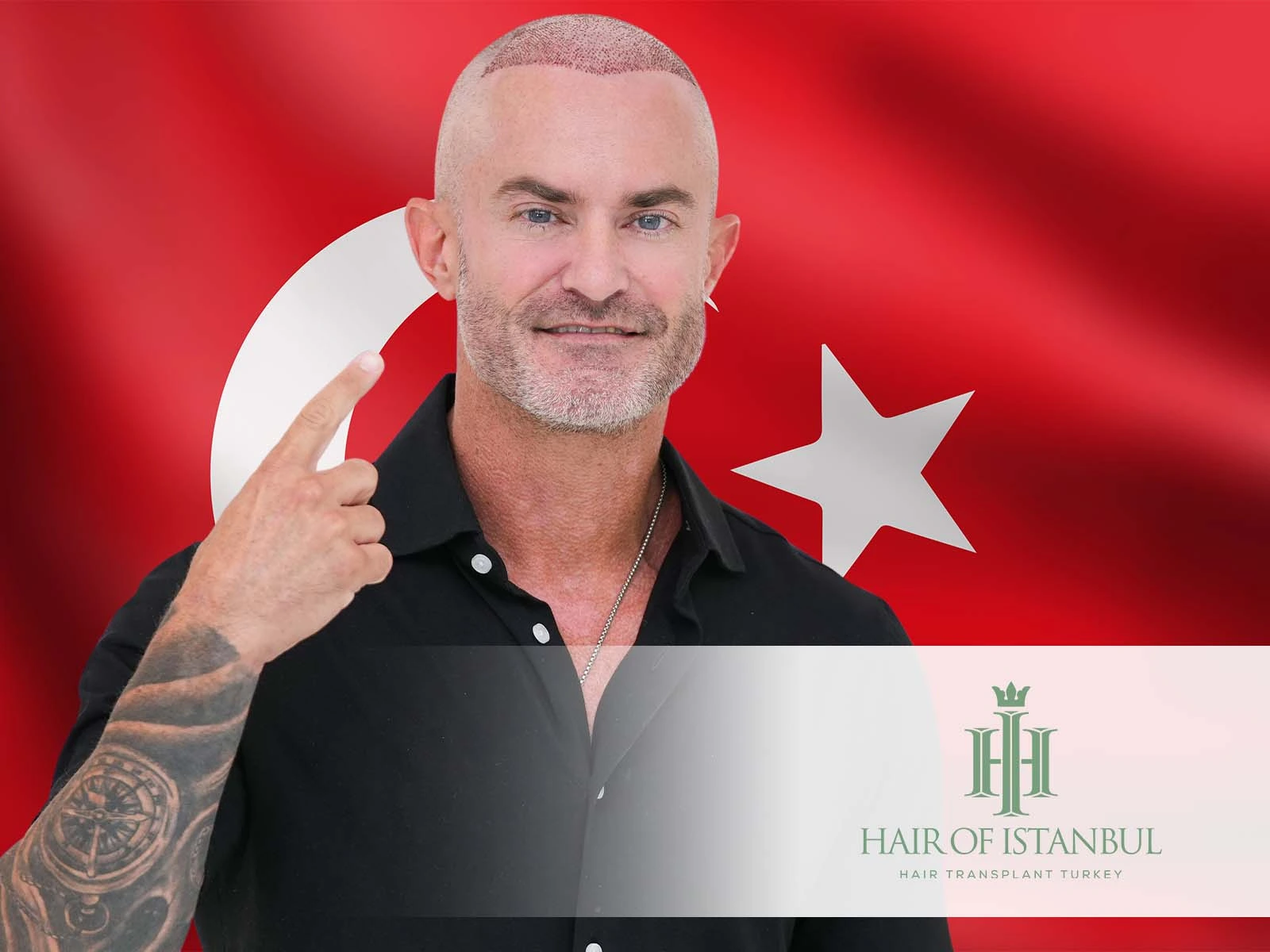 Hair Transplant Turkey