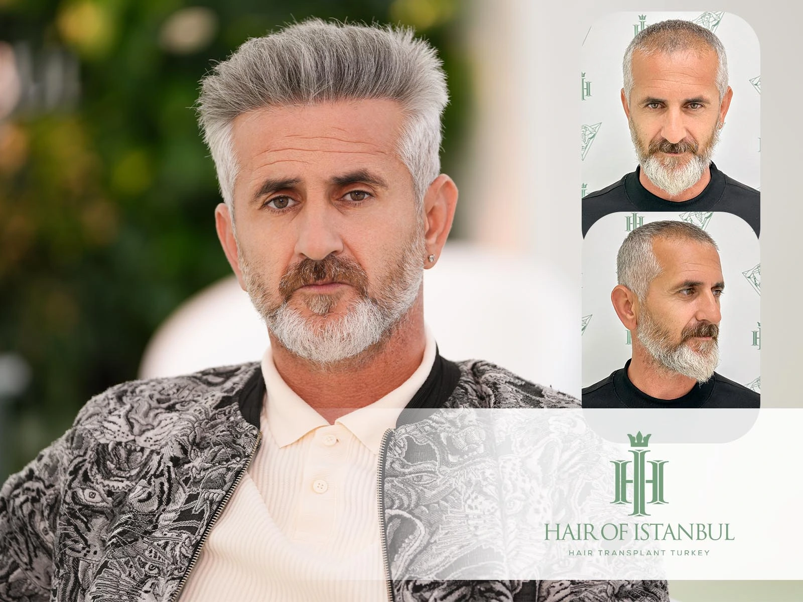 Hair of Istanbul Patient Reviews: Real Stories, Real Results