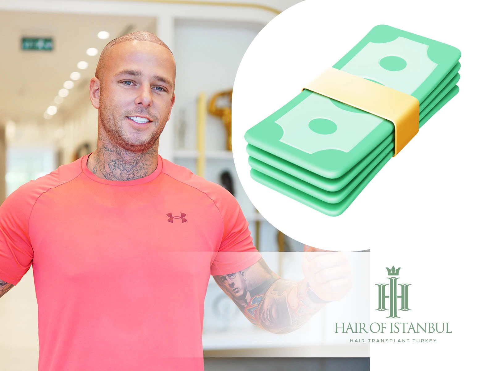 How Much Does Hair Transplant Surgery Price?
