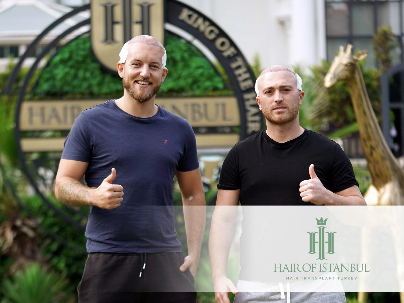 What to Expect During Hair Transplant Recovery Process