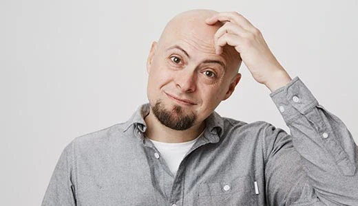 FUE Donor Hair Transplant: Natural Results with Minimal Scarring 2 Who Can Benefit from a FUE Donor Hair Transplant