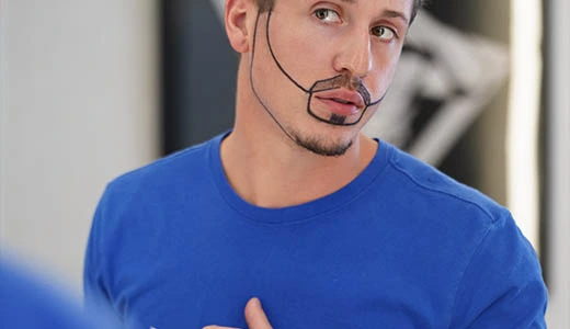 Who Is a Good Candidate for FUE Beard Transplant