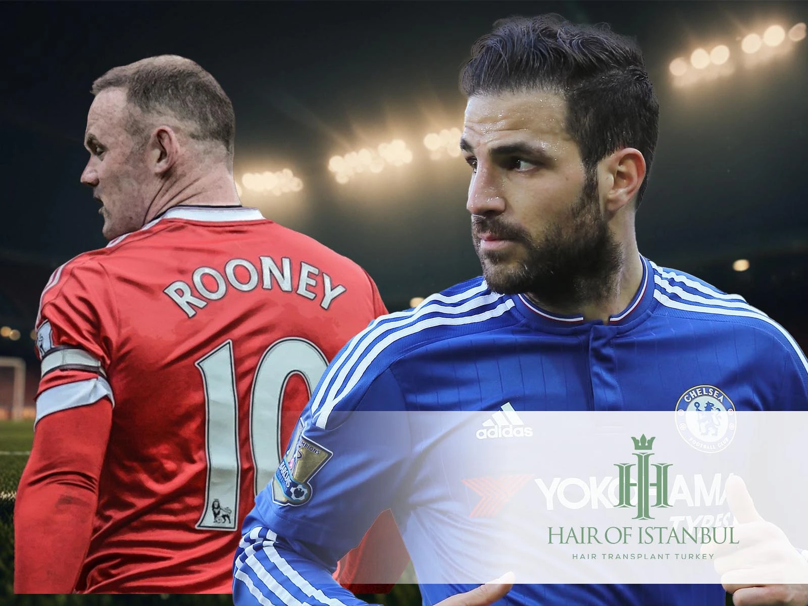 Celebrity Hair Transplants: Football Icons’ Hair Journey