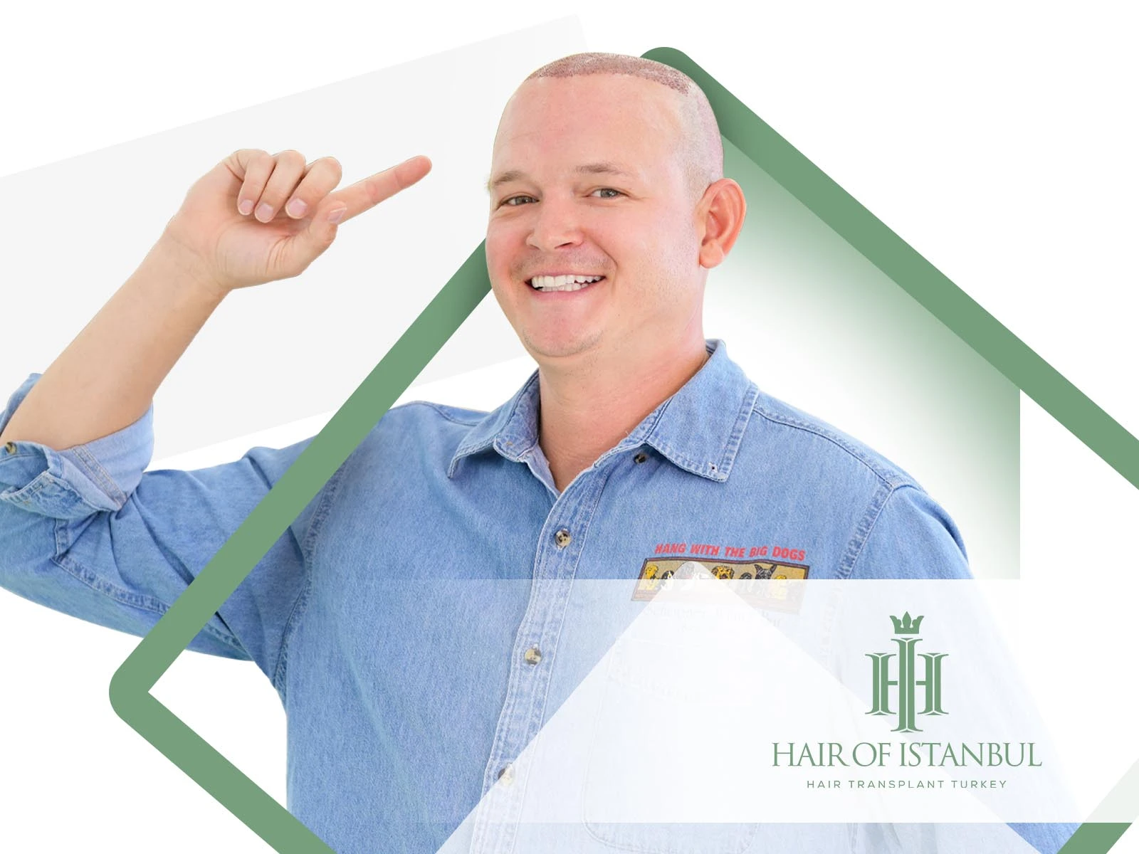 Do Hair Transplants Work: A Clear and Evidence Based Guide