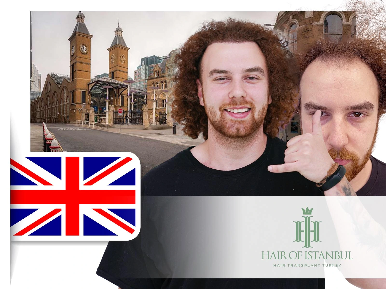 Hair Transplant Centre Liverpool: Your Guide to Restoration