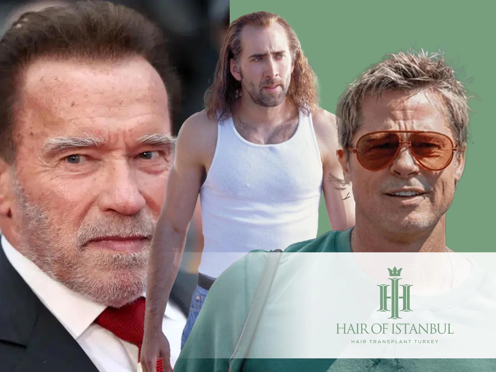 Hair Transplant Famous Actors: Hollywood’s Secrets Revealed