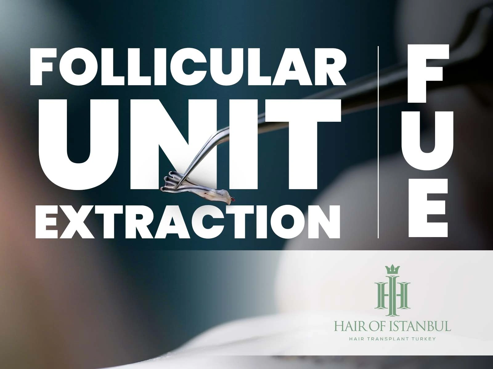 Hair Transplant Follicular Unit Extraction Guide