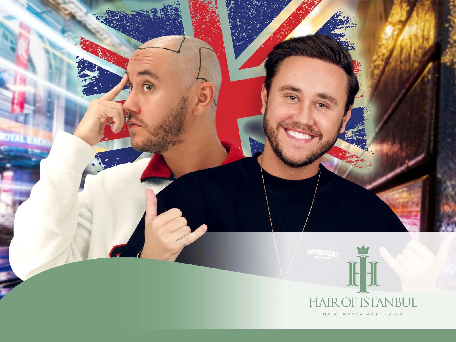 Hair Transplant Manchester: Restore Your Hair with Confidence