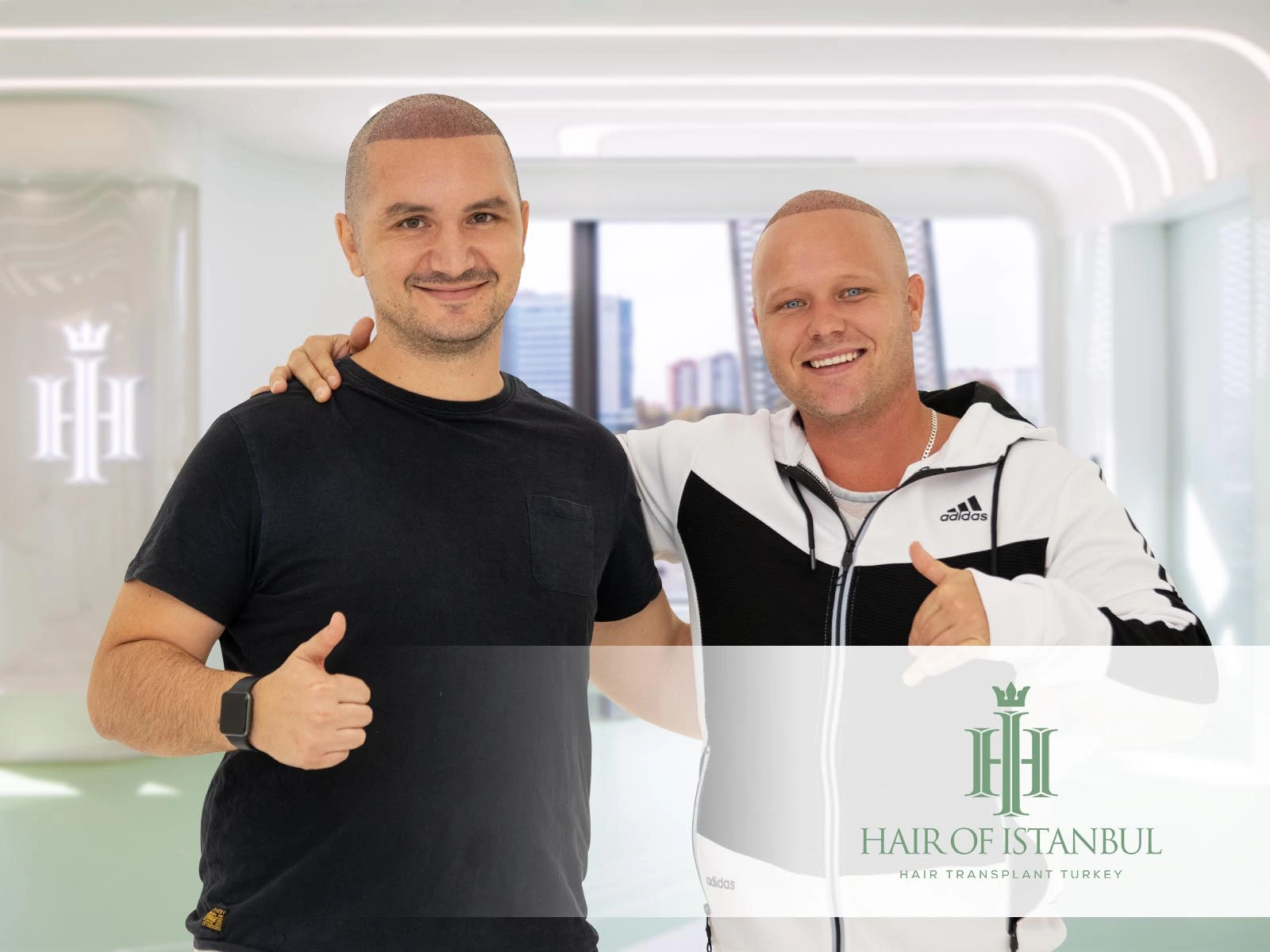 Hair Transplant: Process, Techniques, and Choosing the Right Clinic