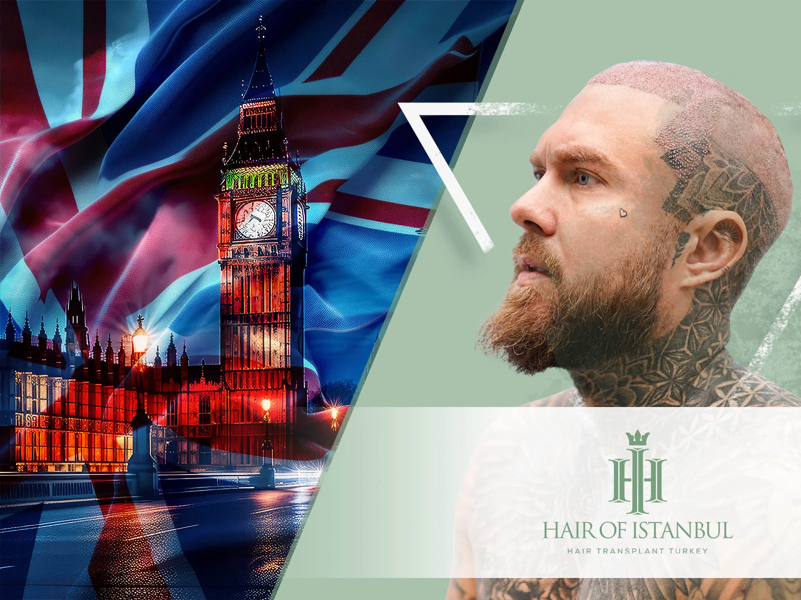 Hair Transplant UK