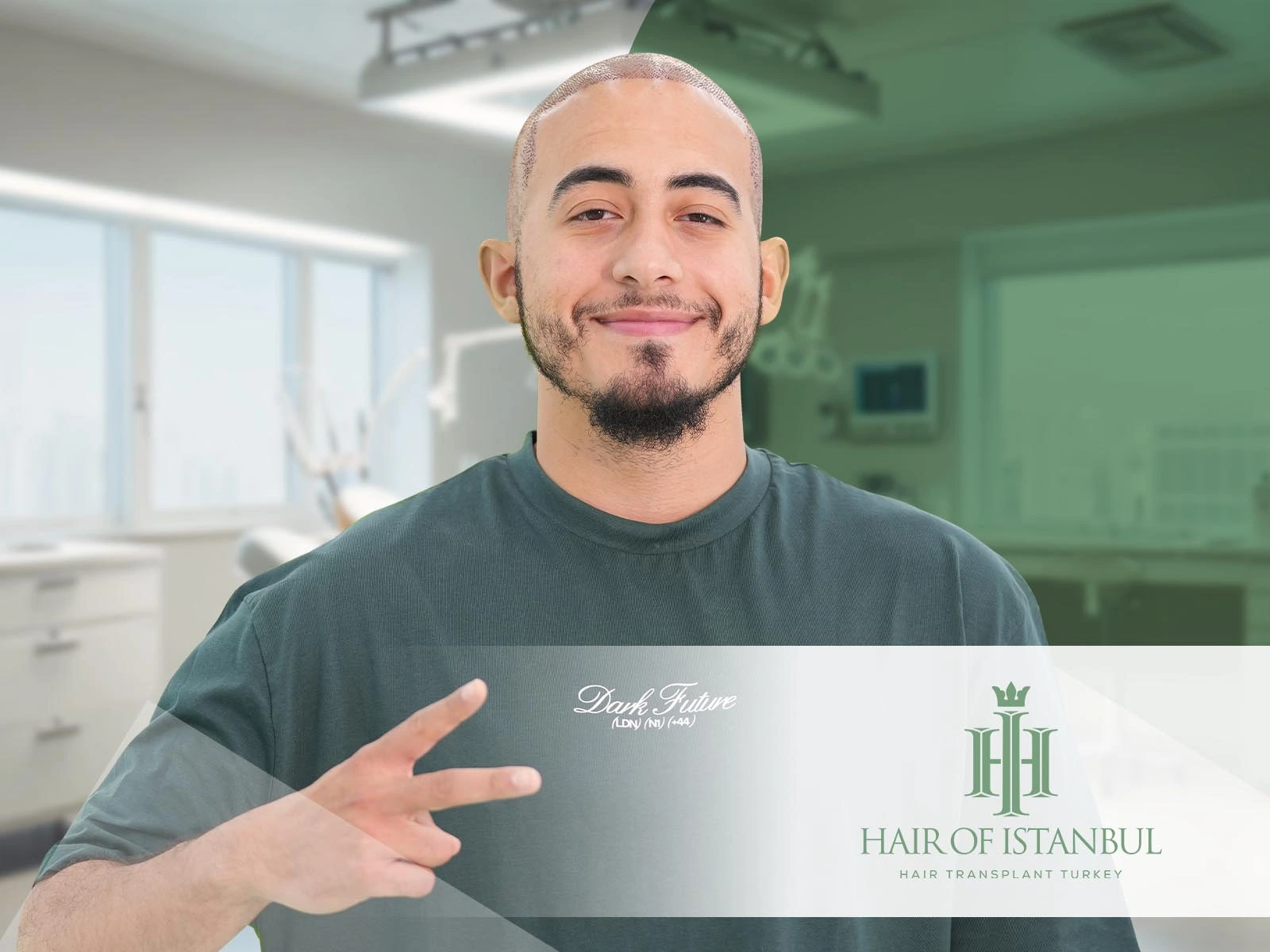 Hair Transplantation in Modern Medicine: Innovation Meets Aesthetics