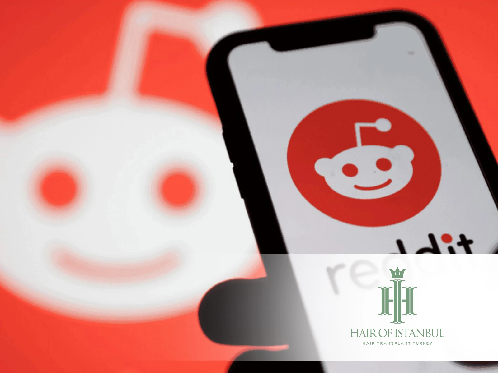 Reddit Hair Transplant: What Real Users Say About Hair Restoration