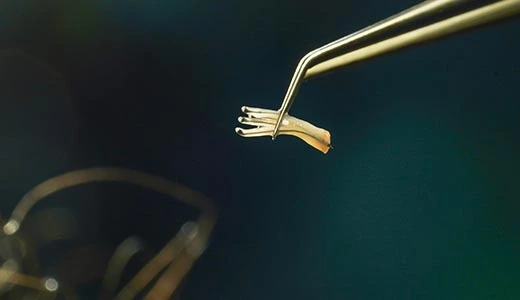 Step 4 Implantation of Hair Follicles