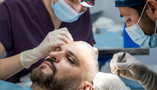 What Is a Surgical Hair Transplant