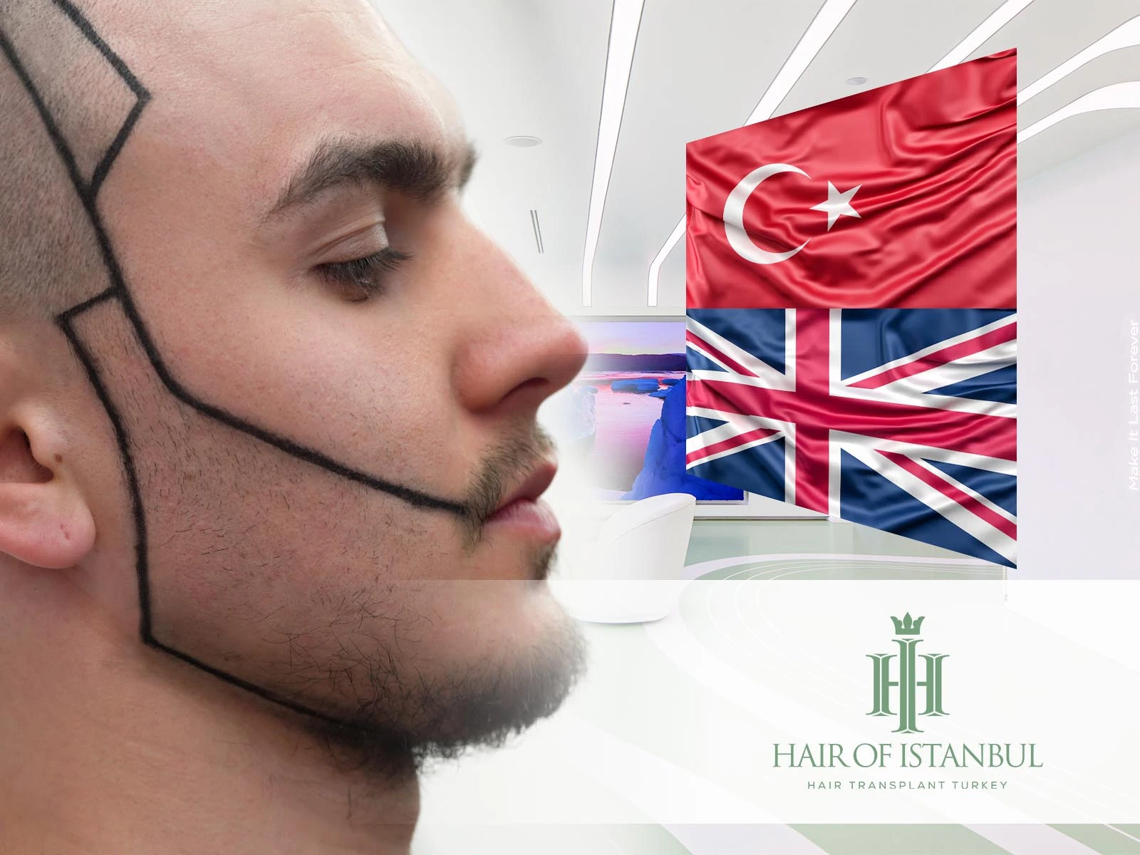 Beard Hair Transplant UK vs Turkish Clinics: Which is Better?