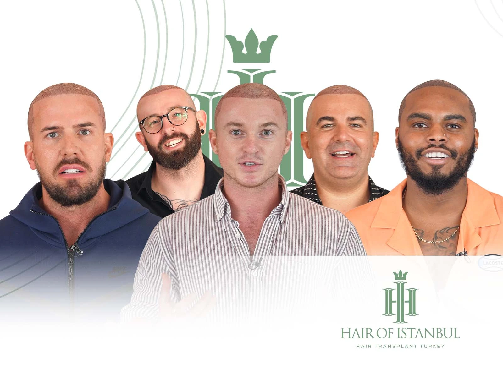 Best Hair Transplant: Discover the Gold Standard in Hair Restoration