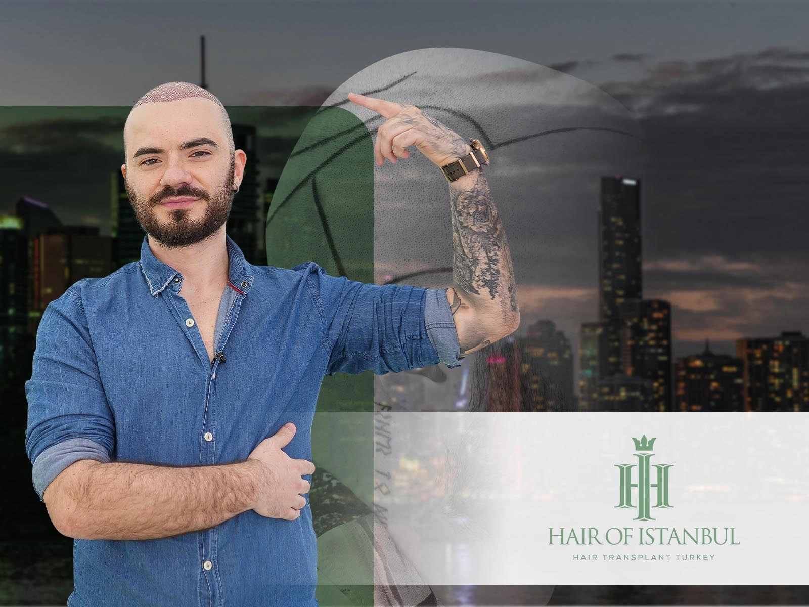 Brisbane Hair Transplant: Why Istanbul May Be a Smarter Option