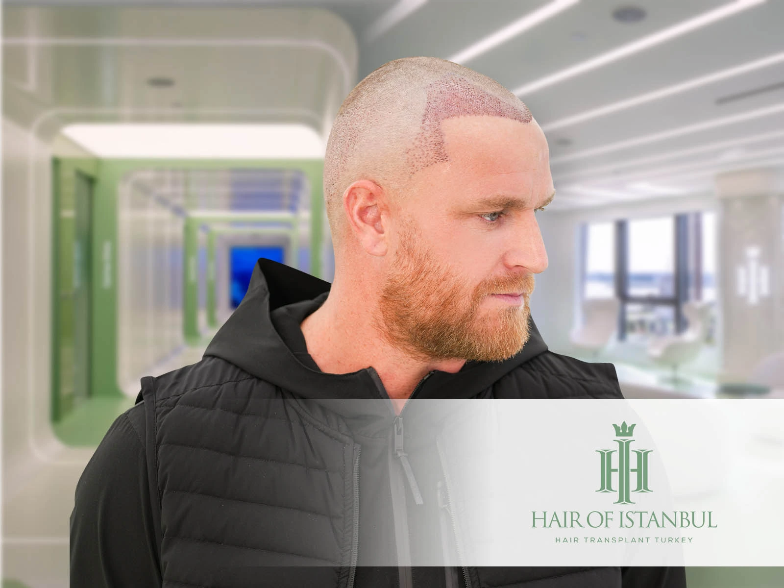 Clinic Hair Transplant: The Right Choice for Lasting Results