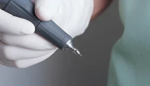 DHI and FUE Method: The Science Behind Extraction and Implantation 2 Comparing FUE Hair Transplant Sydney vs Istanbul