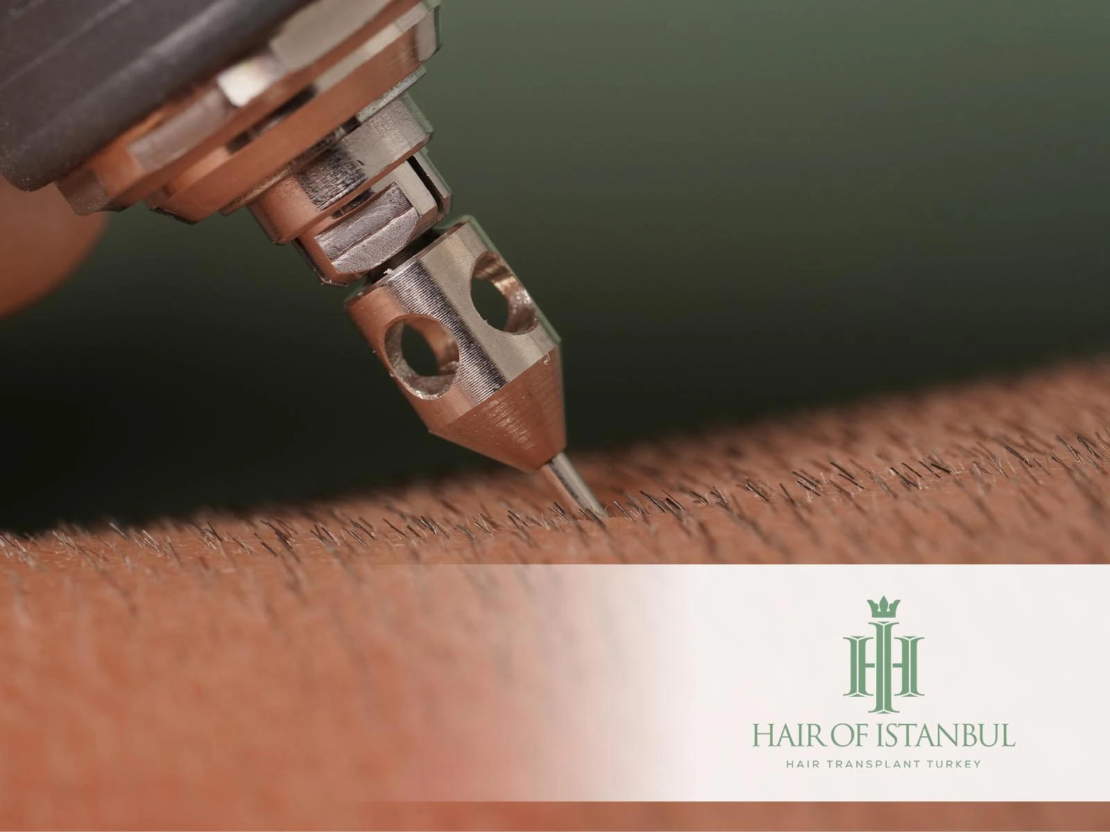 FUE Hair Implant: Discover the Natural Path to Hair Restoration