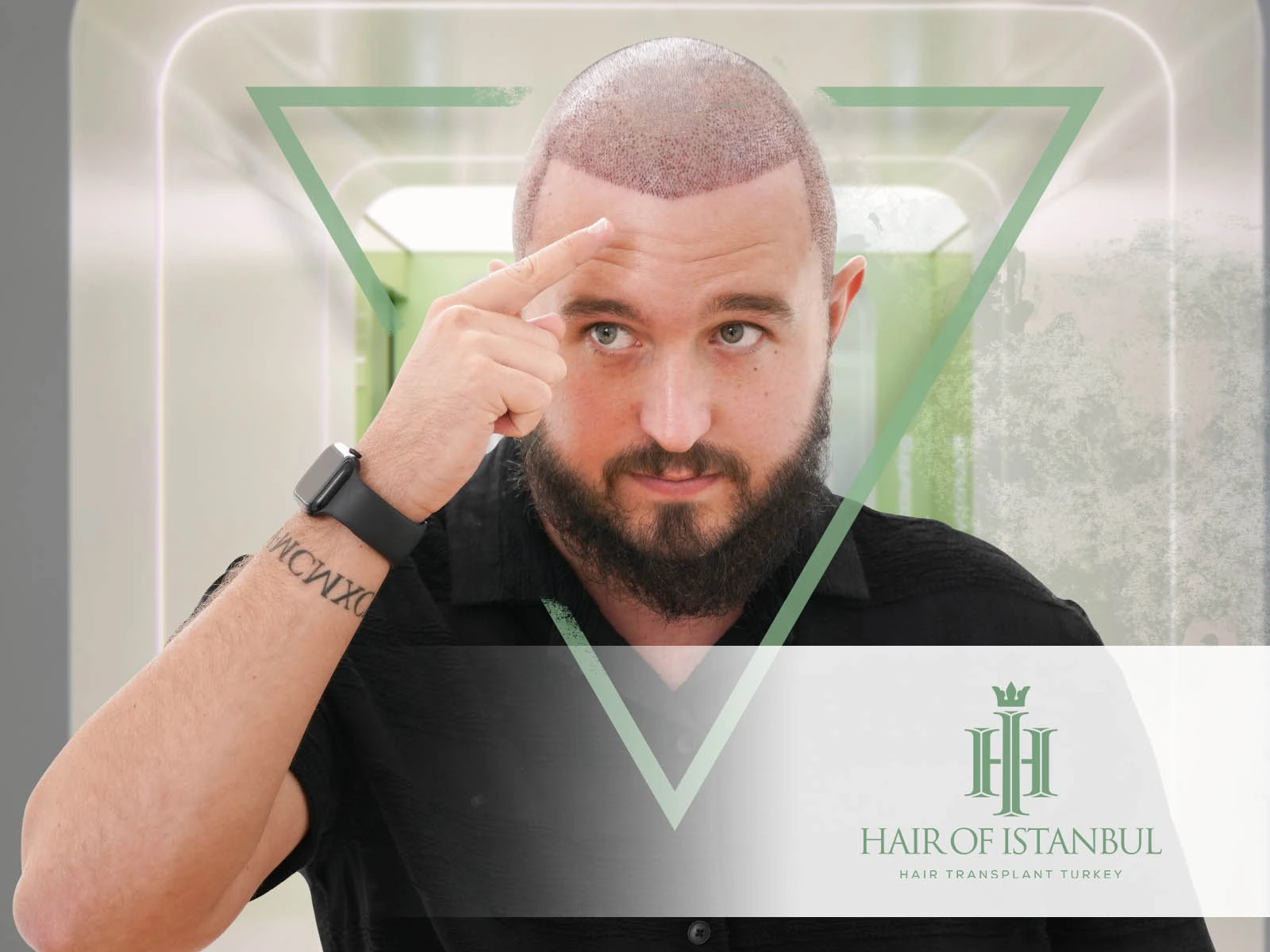 Good Hair Transplant in Turkey: Experience Excellence with Hair of Istanbul