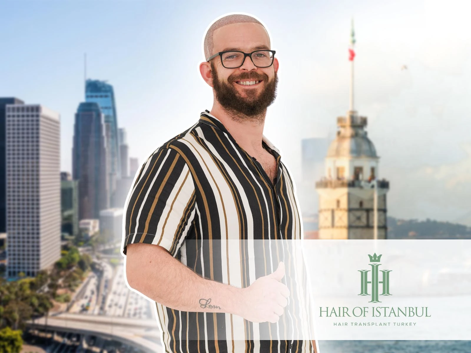 Hair Transplant Adelaide: Discover a World-Class Alternative in Istanbul