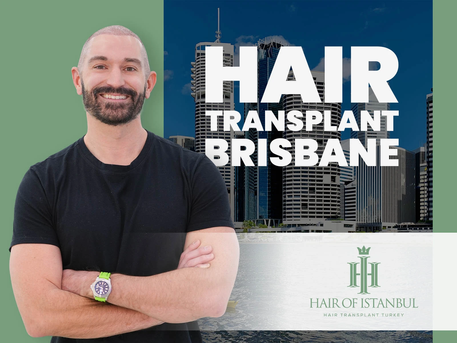 Hair Transplant Brisbane: Exploring Better Global Alternatives
