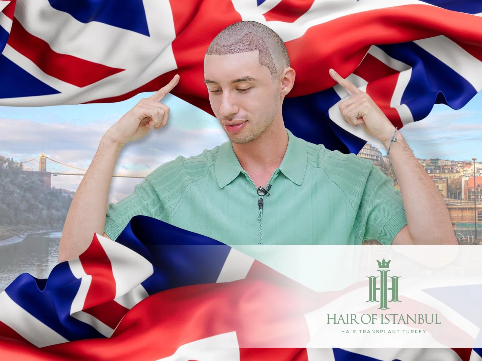 Hair Transplant Bristol: Why Patients Are Looking Beyond Borders