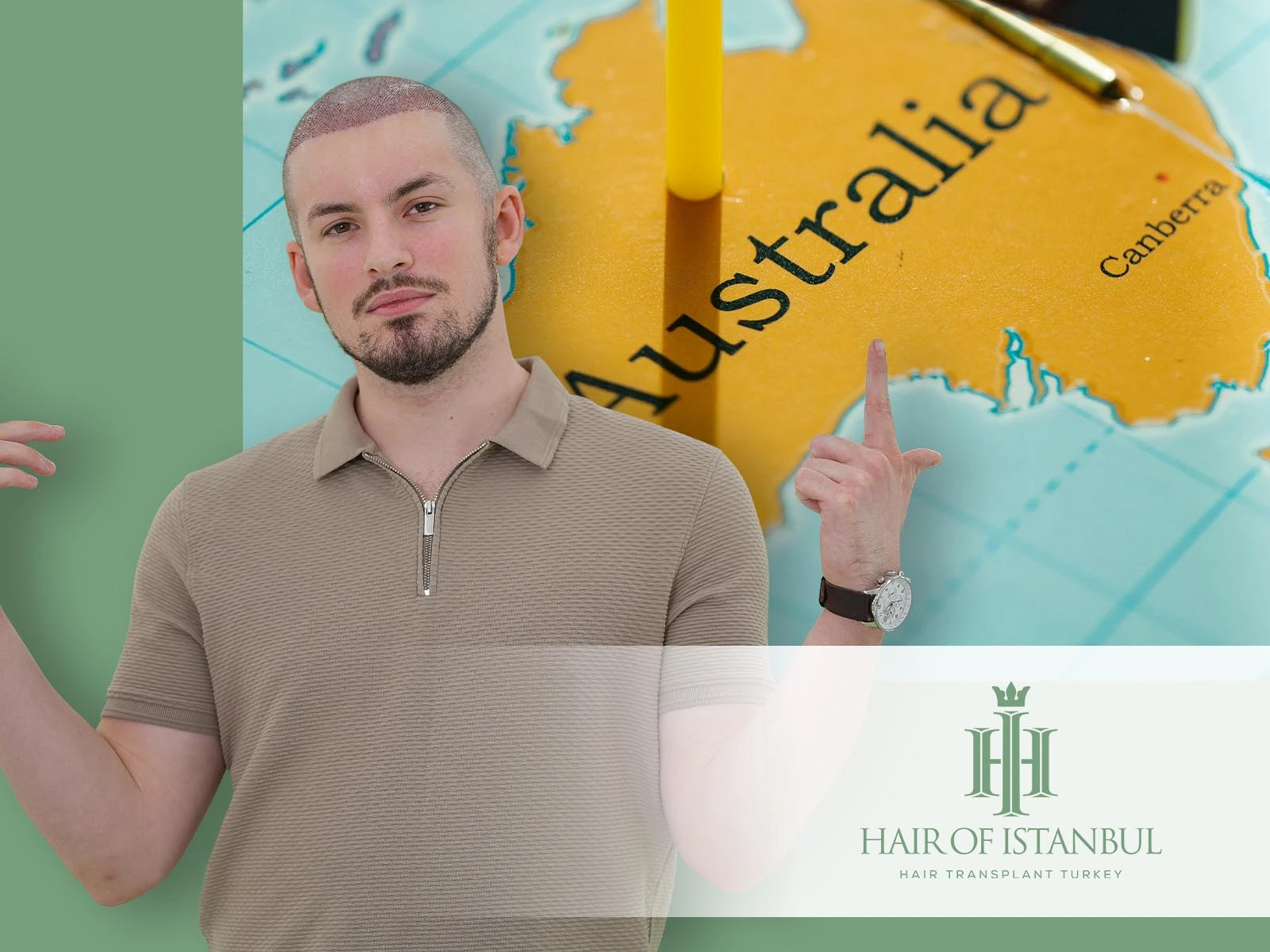 Hair Transplant Canberra: A Global Perspective on Superior Results