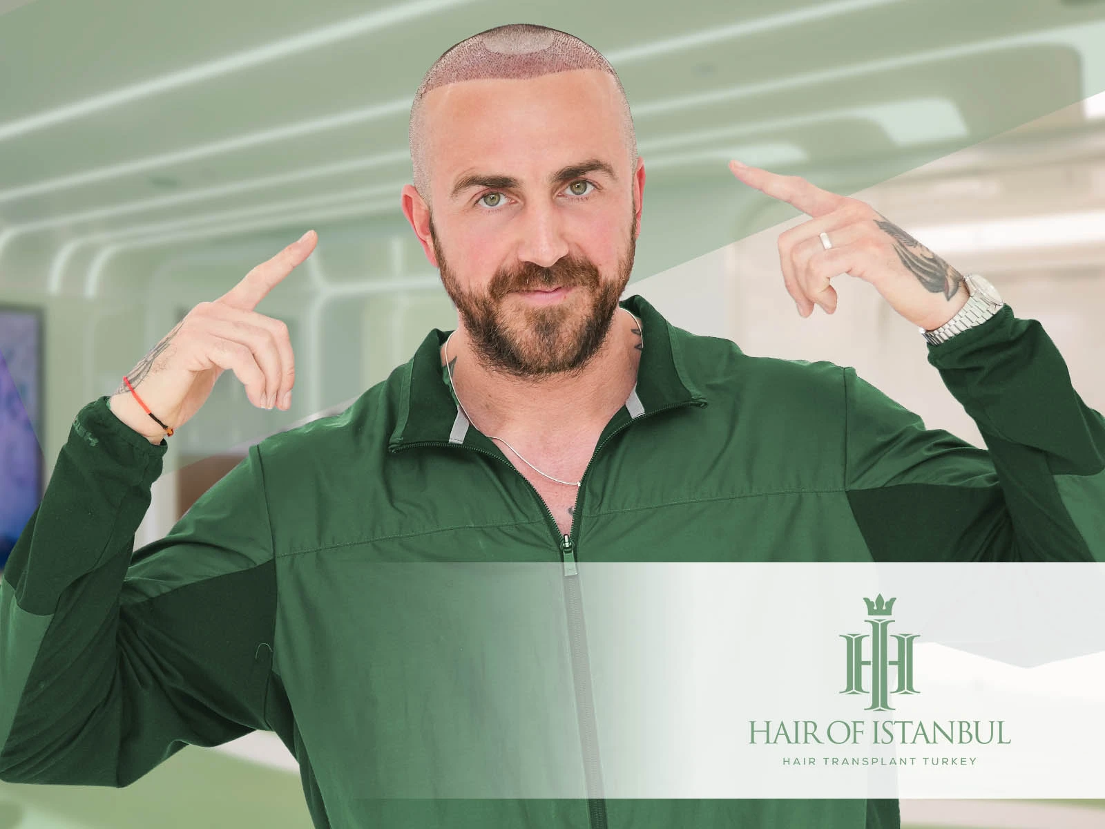 Hair Transplant Leeds: Discover a Better Solution at Hair of Istanbul