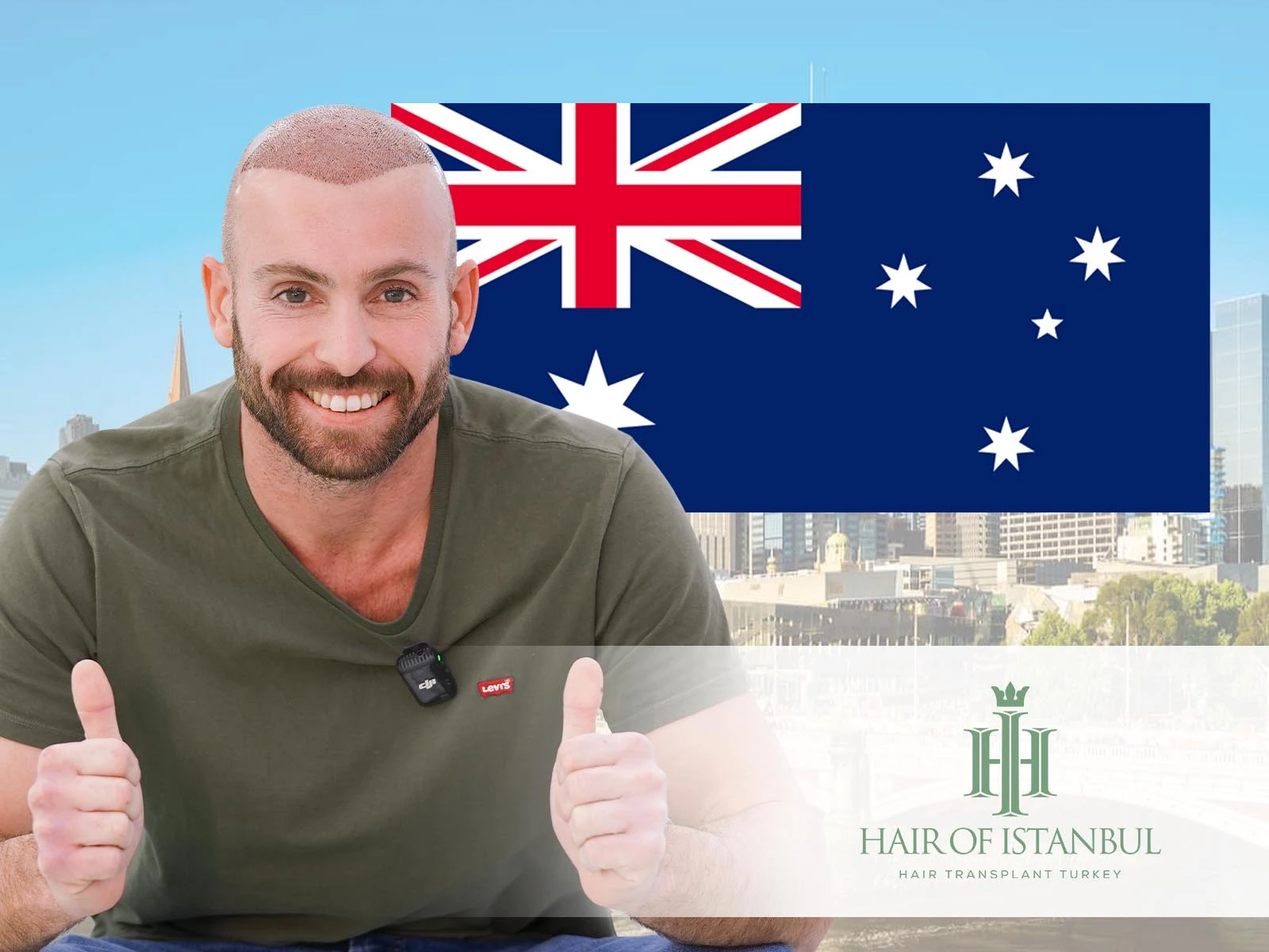 Hair Transplant Melbourne: Why Istanbul Is Becoming the Preferred Destination