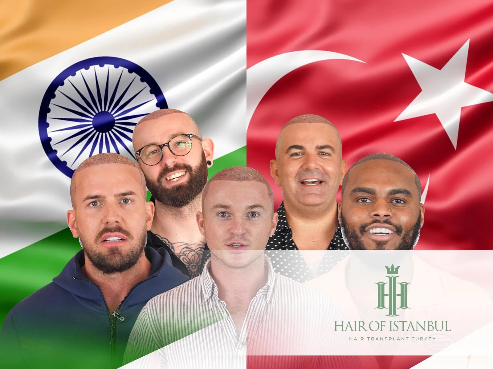 Hair Transplant in India vs Turkey: Why Patients Choose Hair of Istanbul