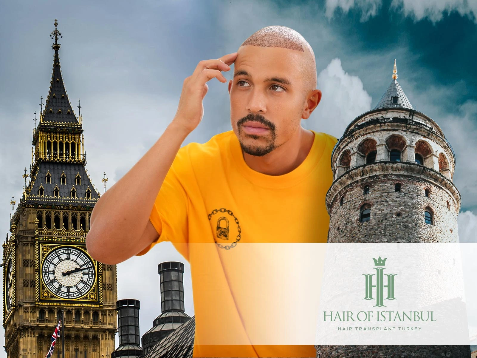 Hair Transplant in London UK: Why Istanbul Offers a Better Alternative