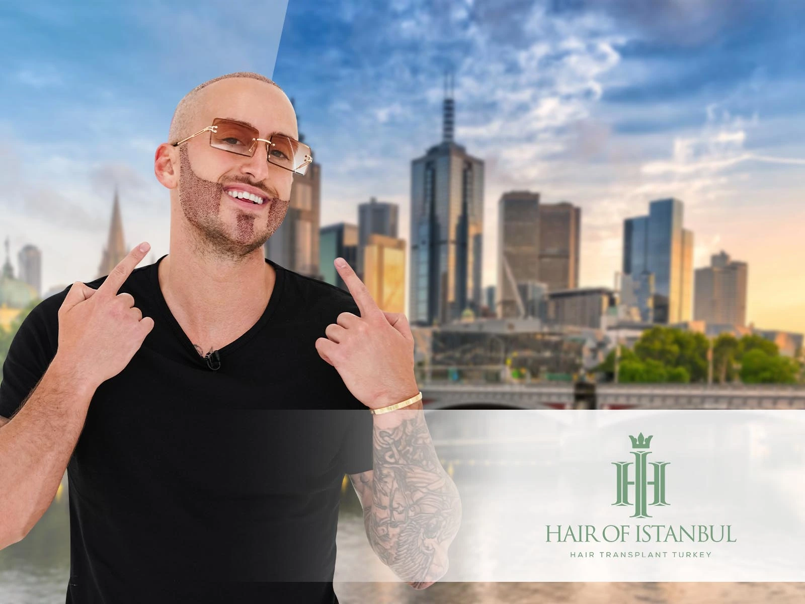 Hair Transplant in Melbourne: Why Turkey Leads the Way