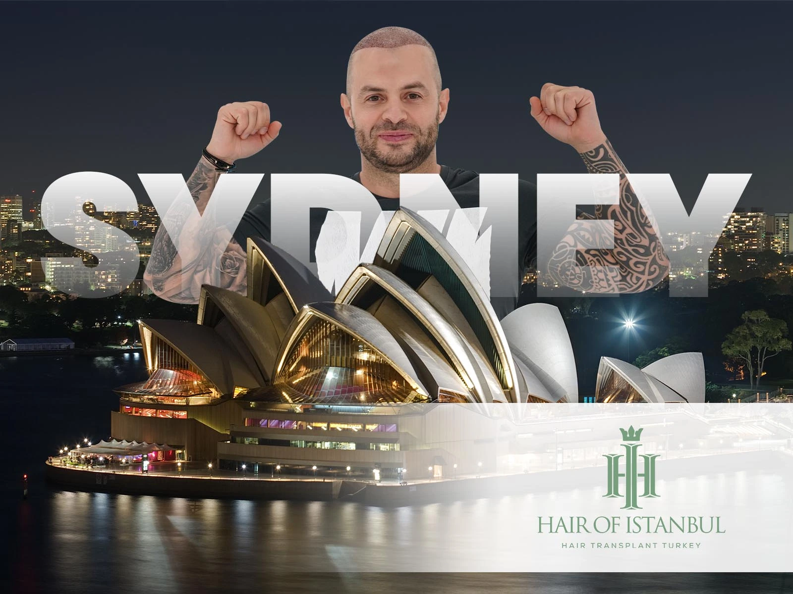 Hair Transplant in Sydney: Why Istanbul Offers a Better Alternative