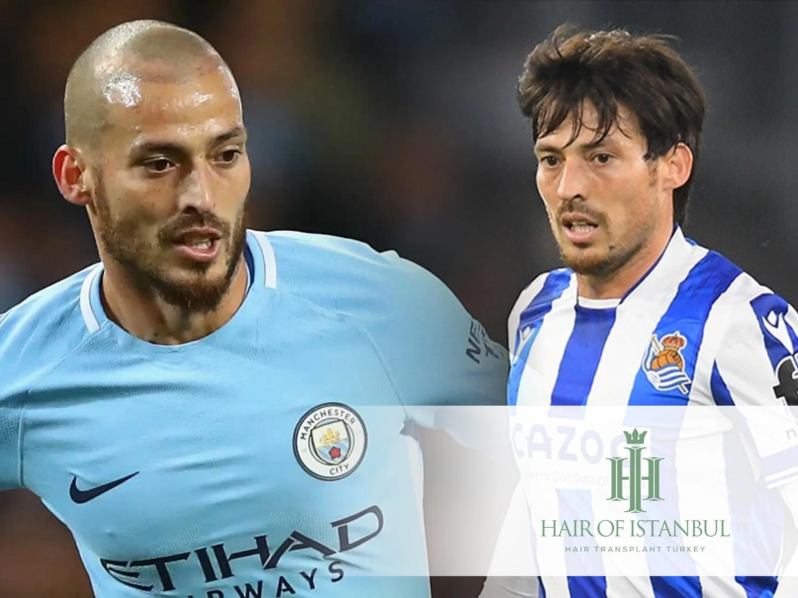 Soccer Player Hair Transplant: Famous Athletes’ Transformations