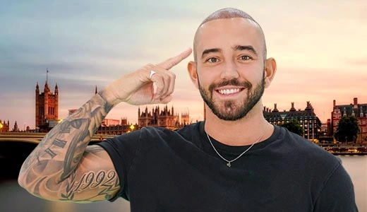 The Current State of Hair Transplant United Kingdom