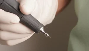 What-is-the-FUE-Hair-Implant-Technique Tecnica Fue