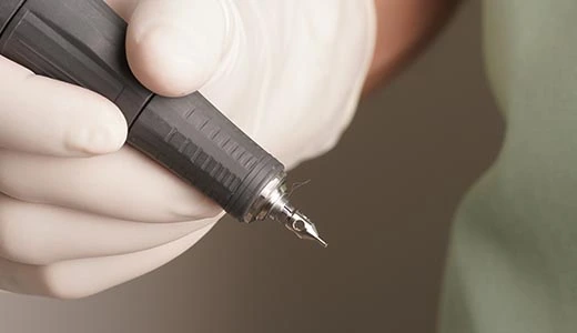 What-is-the-FUE-Hair-Implant-Technique
