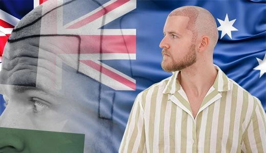 Why Australians Seek Hair Transplants Abroad