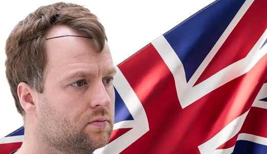 Why Consider Hair Transplant Surgery Outside of London