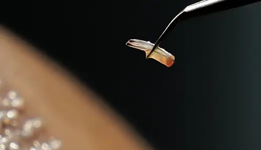 Afro Hair and Micro Hair Transplant Techniques