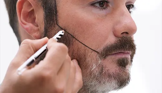 Beard Restoration Beyond Vanity