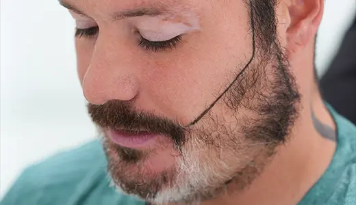 Bread Transplant Options for Everyone