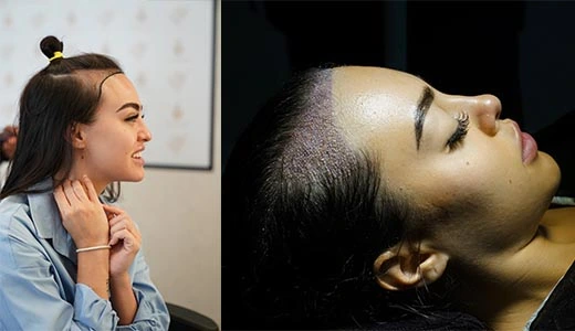 Customization for Natural Results